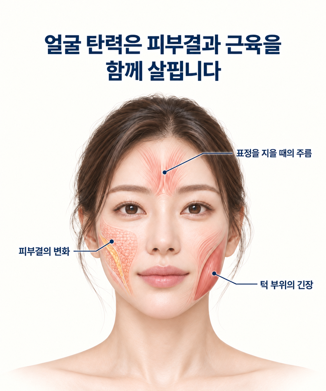 피부결과 얼굴 근육
